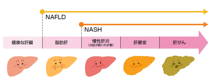 糖尿病と肝臓